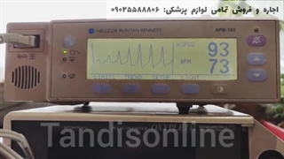طرز استفاده از دستگاه پالس اکسیمتر (پالس نوزاد)