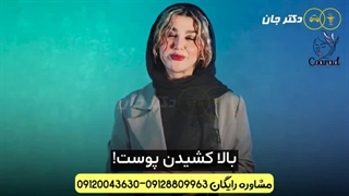 لیفت  متد اسپانیای در کلینیک بین المللی زیبایی کو آراد