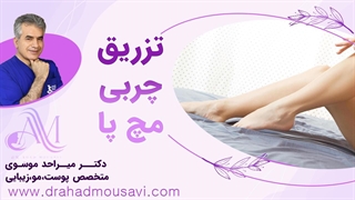 میدونی مچ پای لاغرتو چجور درست کنی