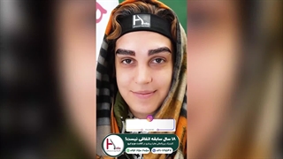 تغییری شگفت‌انگیز با کاشت ابرو