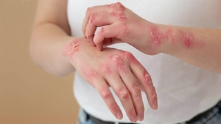 1100 نکته پوست ،مو وزیبایی اگزما ۱ دکترعلی فلاحیان