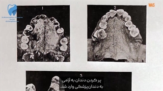 تاریخ دردناک دندانپزشکی