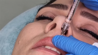 بهترین تزریق فیلر لب