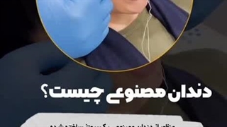 فیلم کاشت دندان مصنوعی ژله ای