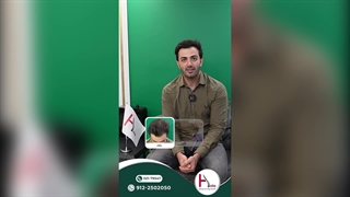 لمس موهای کاشته‌شده همانند موهای طبیعی