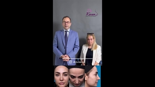 رضایت زیباجو از عمل زیبایی بینی