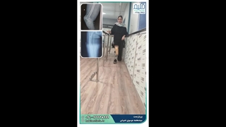 پروتز زیر زانو (مراجعه کننده با شکستگی قسمت فمور استخوان ران)