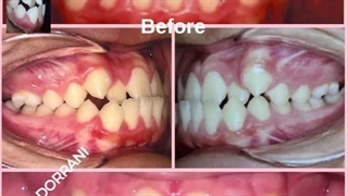 دکتر بهادر درانی
