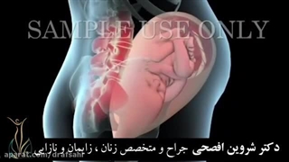 زایمان طبیعی