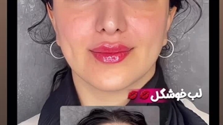 کلینیک زیبایی آرمانی بندرعباس (بهترین دکتر تزریق ژل در بندرعباس) دندان شیری