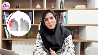 انحراف شست پا