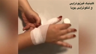 آموزش بانداژ لنف ادم دست توسط خود فرد