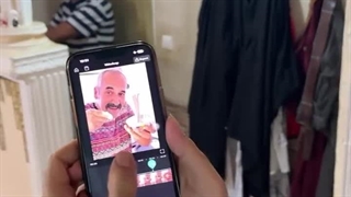 عجب حرکتی زدن 