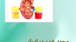 دکتر جاوید غلامی متخصص کلیه ساری جرمگیری