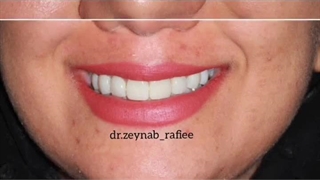 دندانپزشکی دکتر زینب رفیعی ساری دندان شیری