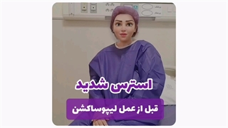 عمل لیپوساکشن در مشهد