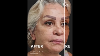 شد الوجه فی إیران