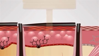 با لیزرهای خانگی هماسنتر، پوستتون رو نوازش کنید!