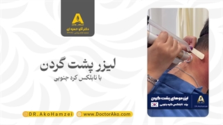 لیزر پشت گردن با دستگاه لیزر نابلکس در کلینیک دکتر آکو حمزه ای