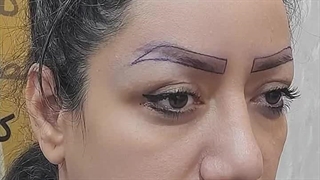 ویدیو کاشت ابرو طبیعی و دائمی در کلینیک بهبد | زیبایی دوباره چهره شما