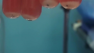 بهترین درمان آرتروز با سلول بنیادی