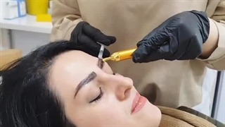 مزوتراپی ابرو