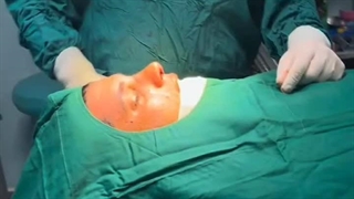 "دکتر الماسی؛ جراحی بینی با ترکیب دانش و ظرافت" جراحی پف زیر چشم