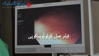 فیلم عمل کولونوسکوپی - partoclinic.com