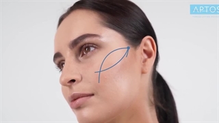 نخ کلاژن ساز آپتوس aptos