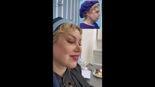 سوپر لیفت صورت و گردن