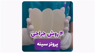 جراحی پروتز در مشهد