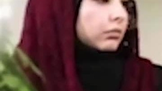 منوچهر نوذری برداشتن خال