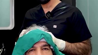 دکتر محمدعلی نیلفروش‌زاده کاشت ابرو