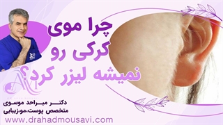 می‌دونی چرا نباید موهای کرکی را لیزر کرد