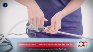 عمل لاپاراسکوپی