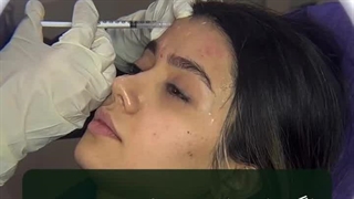 تزریق مزوژل پروایج برای زیباجوی عزیزمون