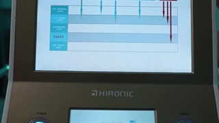 هایفوتراپی در کلینیک آوینا