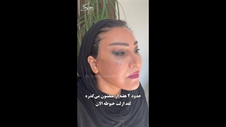 جراحة شد الوجه والرقبة | 20 عامًا من التجدید غیر المشروط