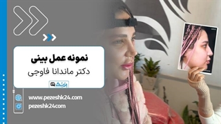 دکتر ماندانا فاوجی جراح بینی در تهران - پزشک 24