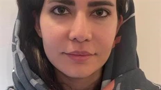 قبل و بعد از کاشت ابروی طبیعی