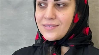 قبل و بعد از کاشت ابروی طبیعی