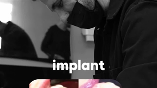 ایمپلنت دندان در دندانپزشکی گلدن ایمپلنت