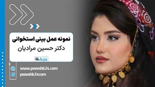 عمل بینی استخوانی با دکتر حسین مرادیان در شیراز - پزشک 24