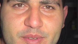 بهترین جراح بینی مردانه در تهران