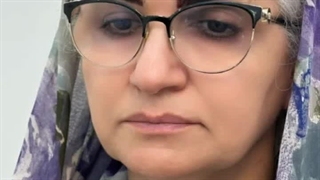 تزریق فیلر لب در کلینیک رنسانس