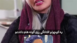بهترین جراح لیفت آندوسکوپیک در تهران وکرج