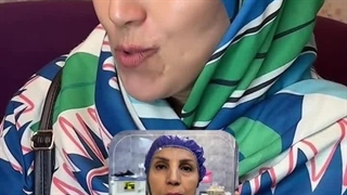 لیفت صورت در تهران وکرج