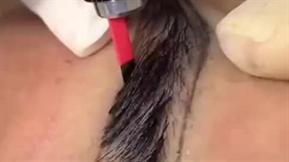 خدمات فیبروز و میکروبلیدینگ ابتسام مچری در شاهین شهر اصفهان