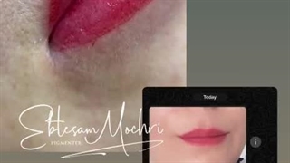 خدمات فیبروز و میکروبلیدینگ ابتسام مچری در شاهین شهر اصفهان