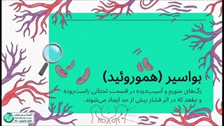 13 روش طلایی برای درمان بواسیر در خانه و با دارو-کلینیک پایتخت